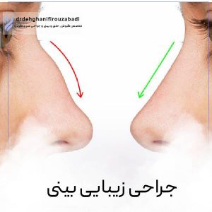 عمل زیبایی بینی