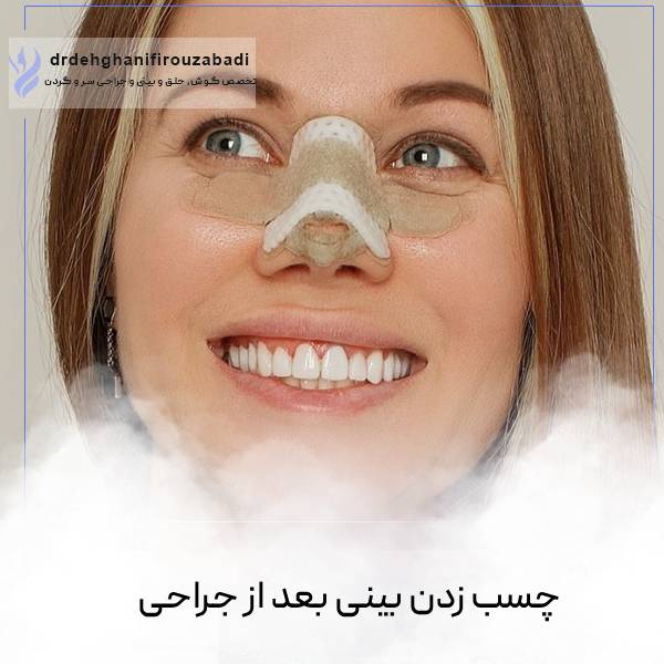 چسب بینی بعد از جراحی