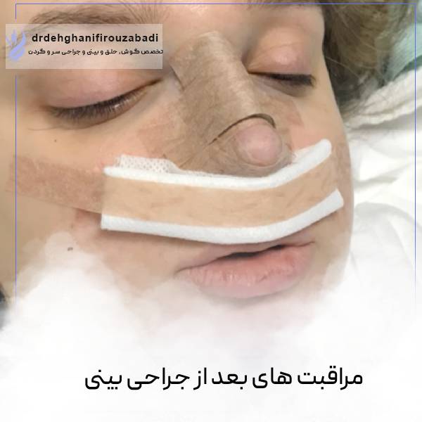 مراقبت های بعد از جراحی بینی